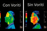 Vortex (Pack 6) - Chip de Protección de Radiación